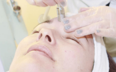 Microdermabrasion At Home? Leave It To The Pros