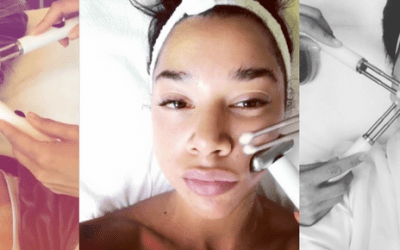 Why Models and Millennials Love Microcurrent Facials